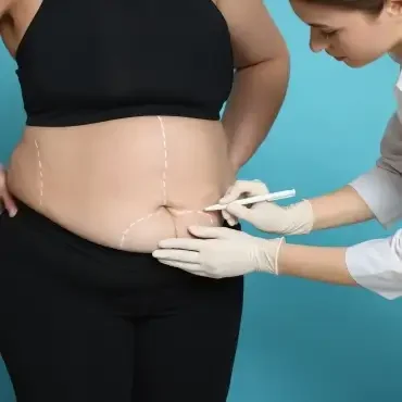 Liposuction by Best Plastic surgeon in Mumbai