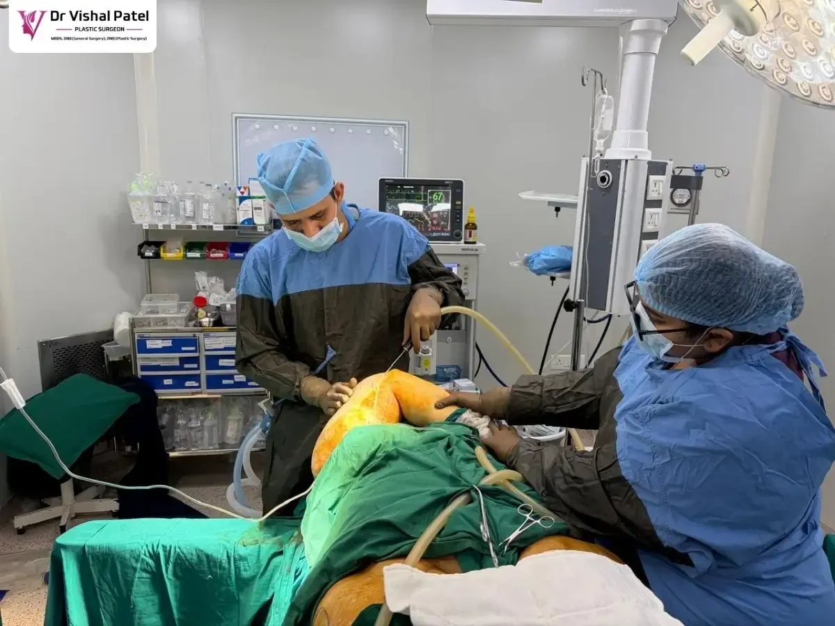 Live Arm Liposuction in Mumbai by Dr. Vishal Patel
