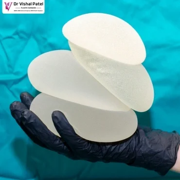 Multiple Silicone Gel Breast Implant in Mumbai - By Dr. Vishal Patel