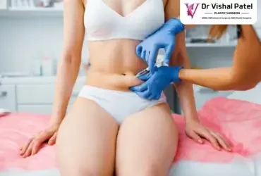 Non surgical tummy tuck in Mumbai by Dr Vishal Patel