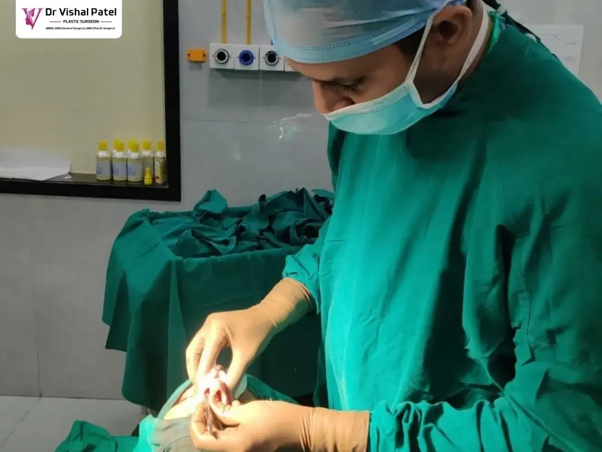 Nose Alarplasty in Mumbai by Dr. Vishal Patel