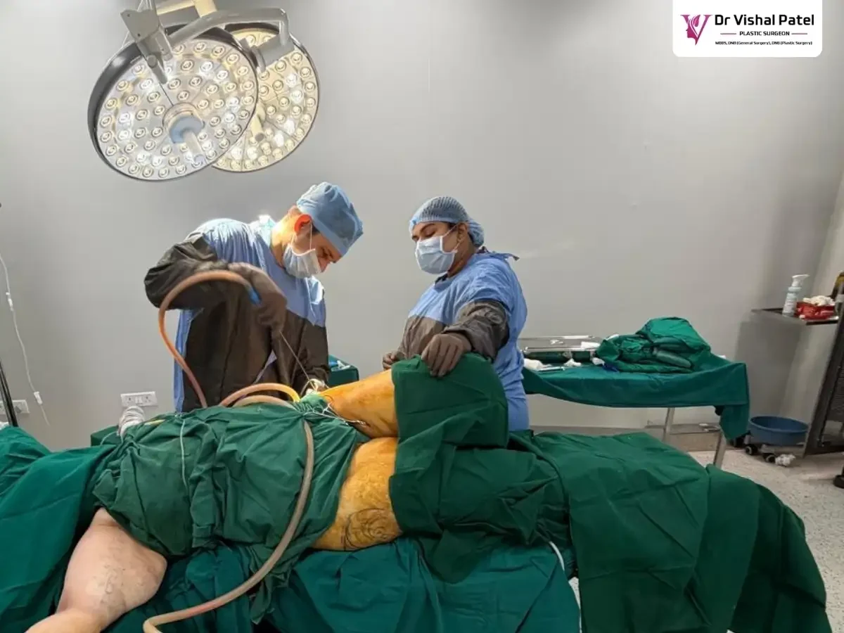 Plastic Surgery with Medical Financing in Mumbai by Dr. Vishal Patel