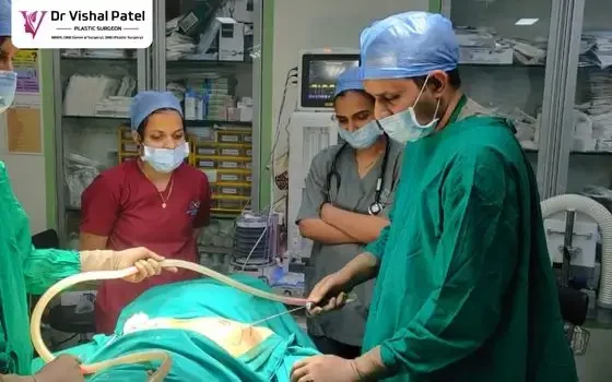 Dr. Vishal Patel doing Chest fat removal using Power liposuction technique.