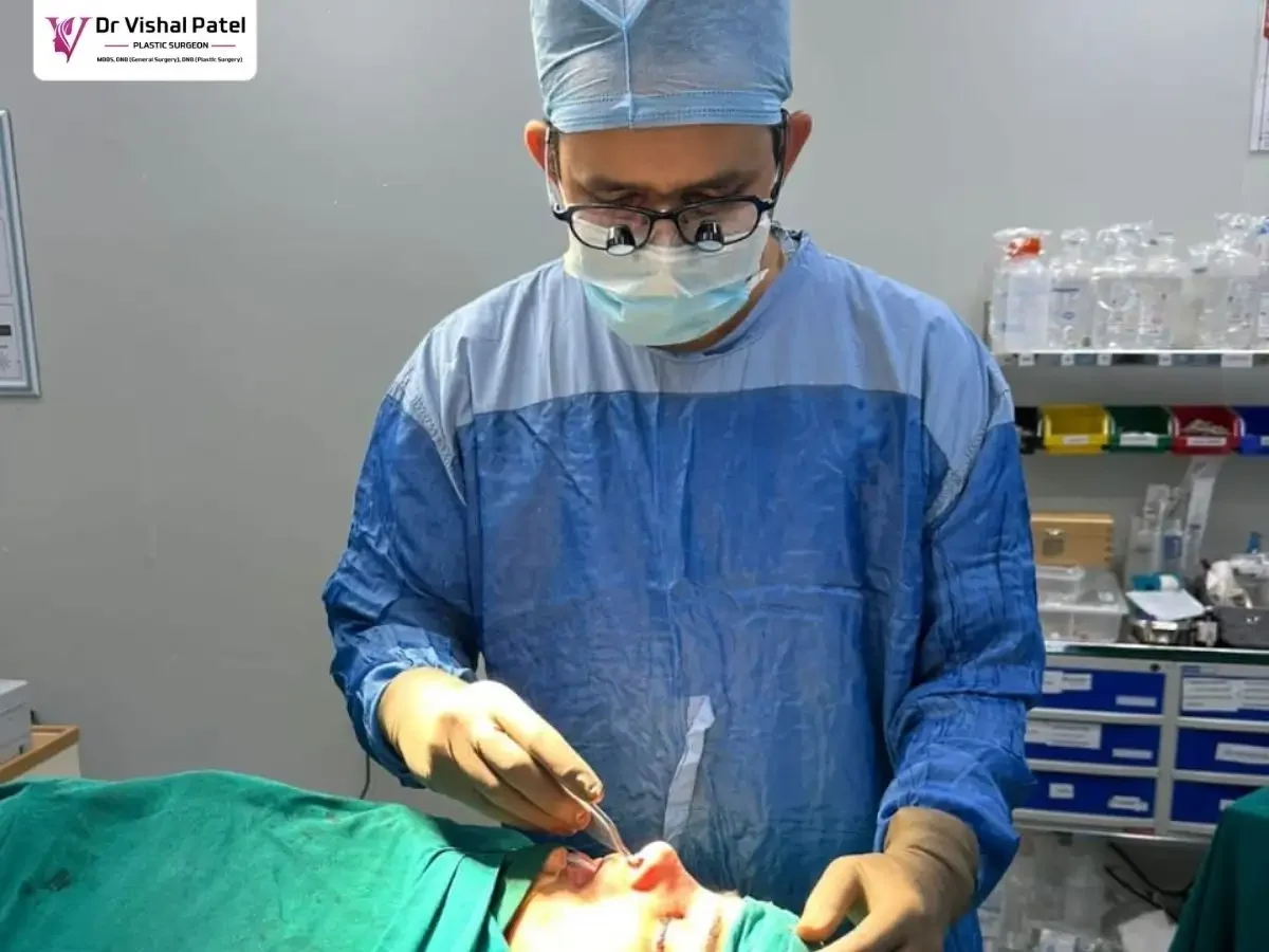 Dr. Vishal Patel during revision rhinoplasty surgery in Mumbai.