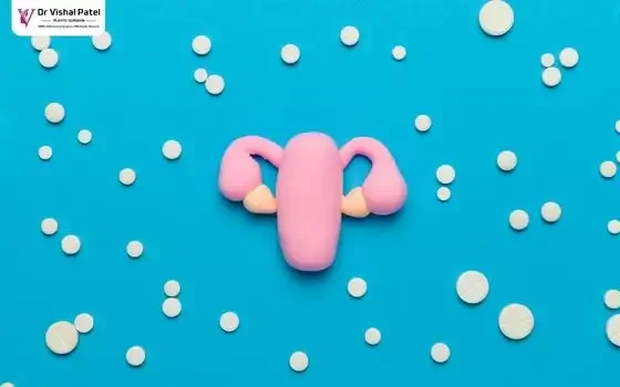 Illustration of Revision Vaginoplasty.