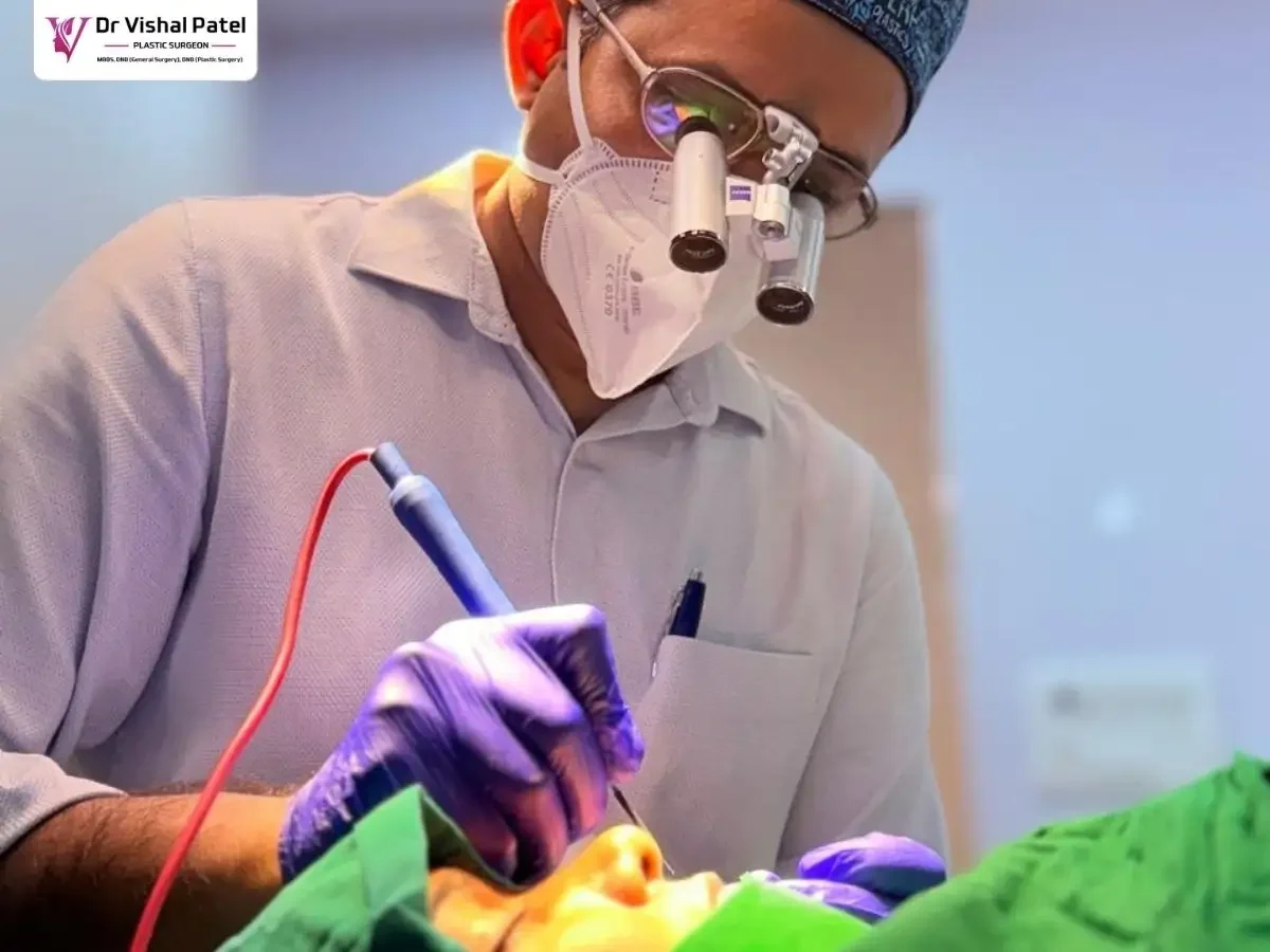 Dr. Vishal Patel doing Acne scar removal treatment in Mumbai using dermaroller.