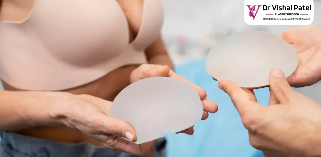 Silicone breast implant cup held in hands.