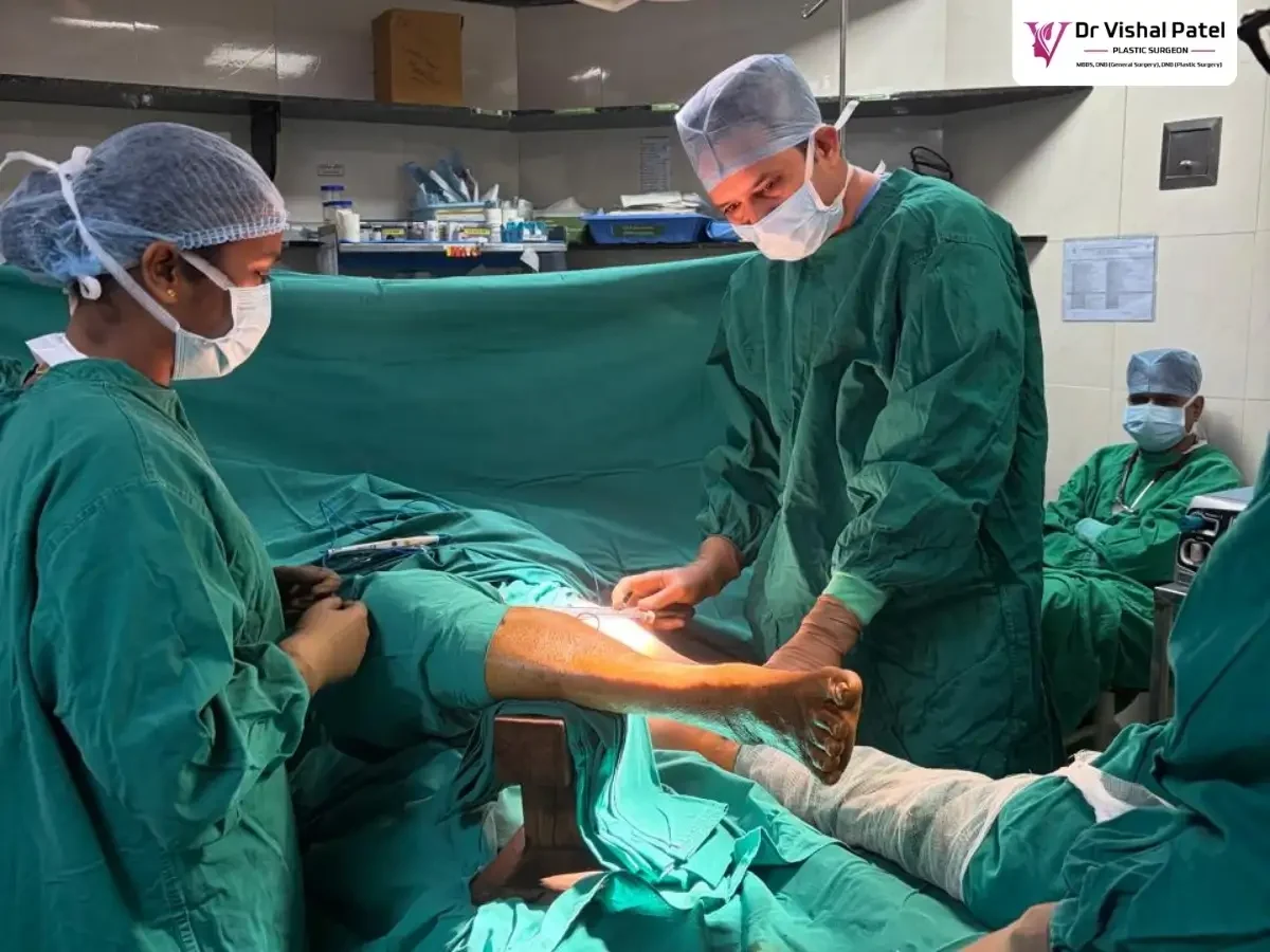 Dr. Vishal Patel with medical staff harvesting skin from donor region.