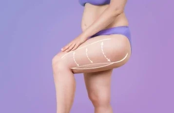 Thigh Lift Surgery in Mumbai - Dr Vishal Patel