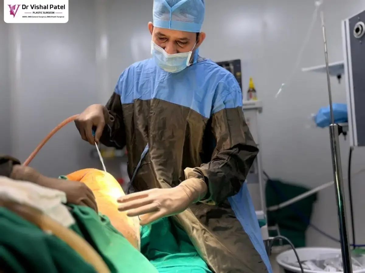 Dr. Vishal Patel performing Tummy tuck in Mumbai.