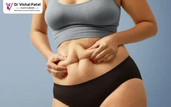Tummy Tuck in Mommy makeover surgery in Mumbai India Tummy Tuck in Mommy makeover surgery in Mumbai India