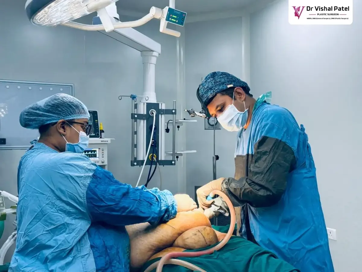 Tummy Tuck with Medical Financing in Mumbai by Dr. Vishal Patel