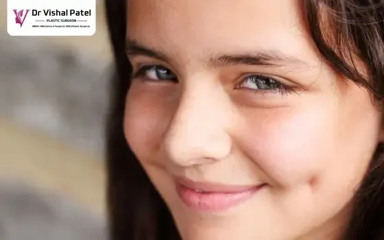 Unilateral Cheek Dimple Creation Surgery in Mumbai – Dr. Vishal Patel Unilateral Cheek Dimple Creation Surgery in Mumbai - Dr. Vishal Patel