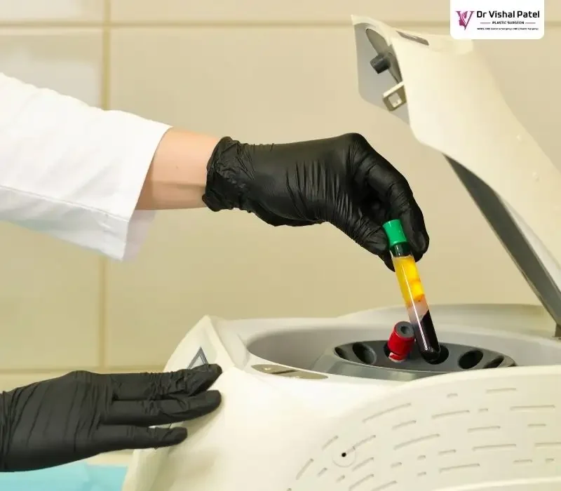 Blood samples in centrifuge machine.