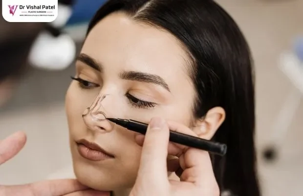 What is Rhinoplasty What is Rhinoplasty