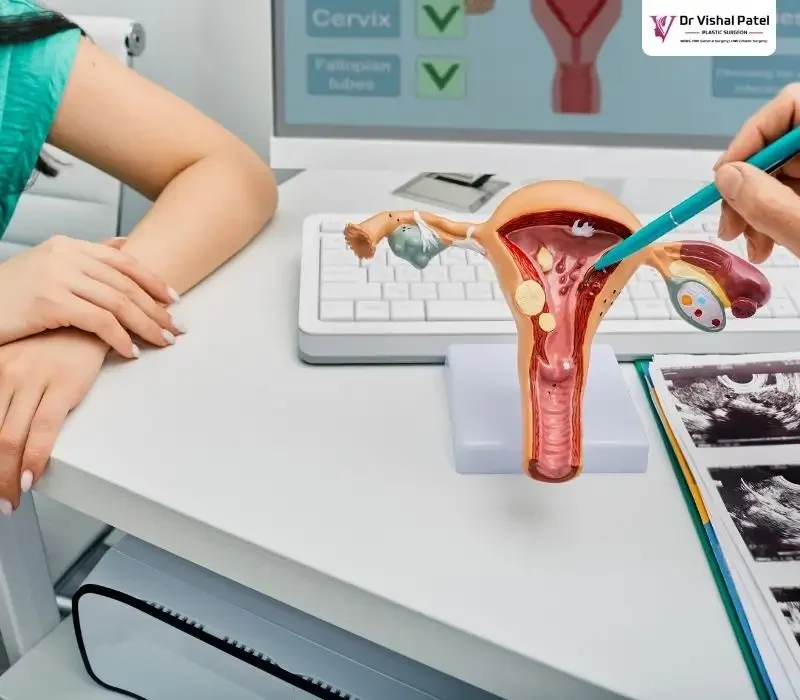 What is Vaginoplasty - Explained by Dr. Vishal Patel