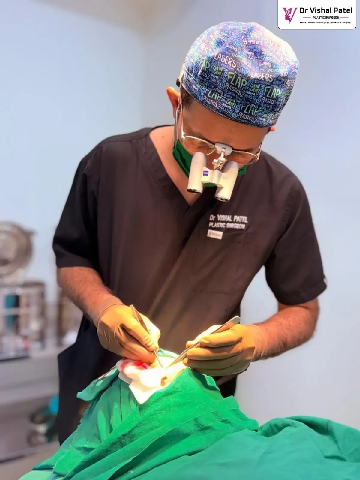 Dr. Vishal Patel doing Xanthelasma treatment in Mumbai.