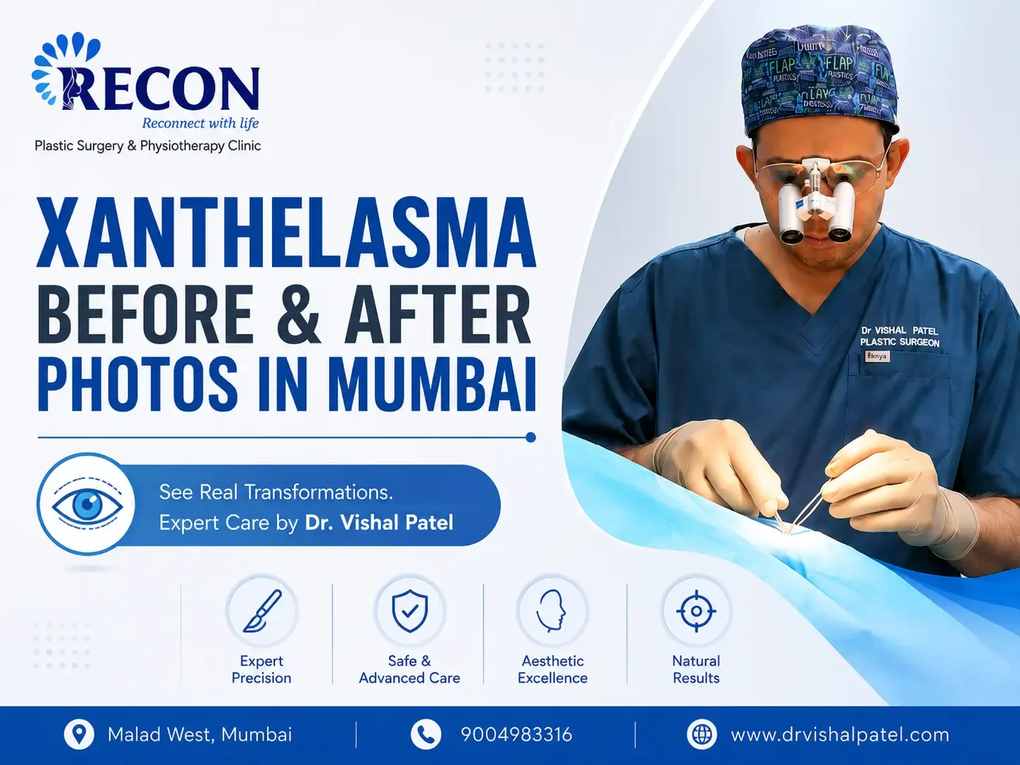 Xanthelasma before after photos in Mumbai by Dr. Vishal Patel